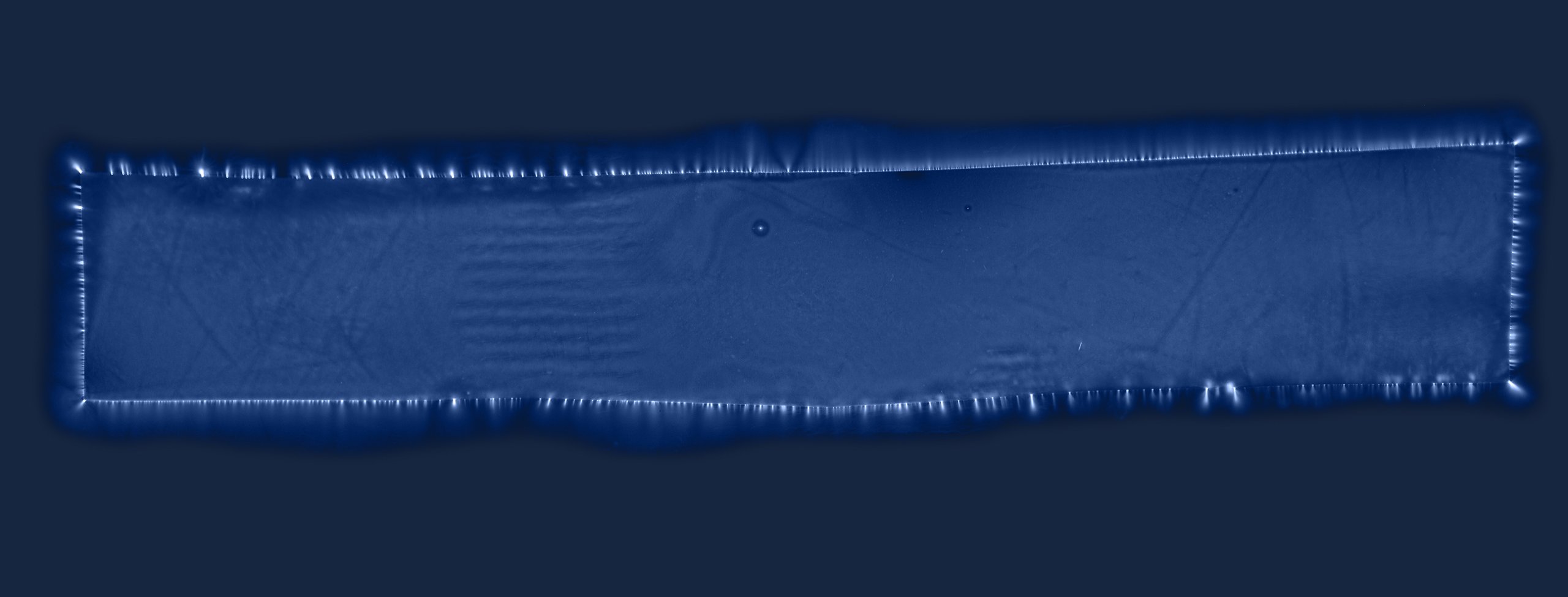 X Ray image to illustrate Tech Index