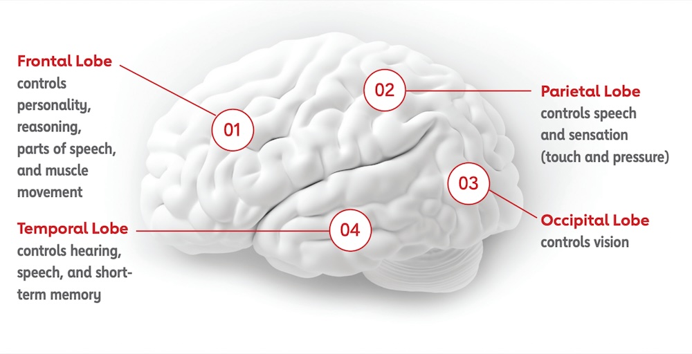 Chart showing impact of stroke on different regions of the brain