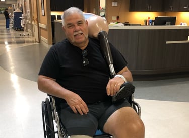 Dave, an amputation survivor, sits in a wheelchair in a hospital hallway holding a prosthetic leg across his shoulder.