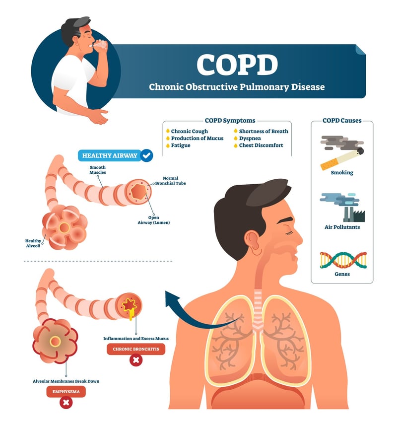 chart showing copd symptoms and causes