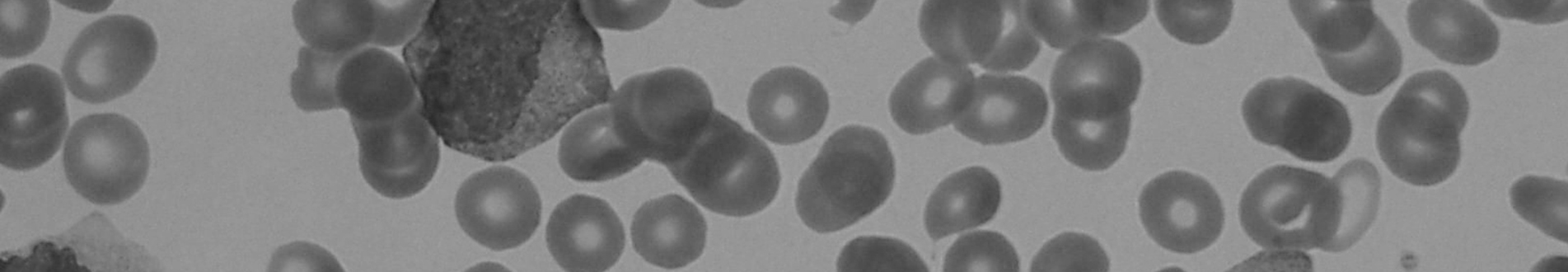 Bolstering regional Australians’ fight against blood cancer