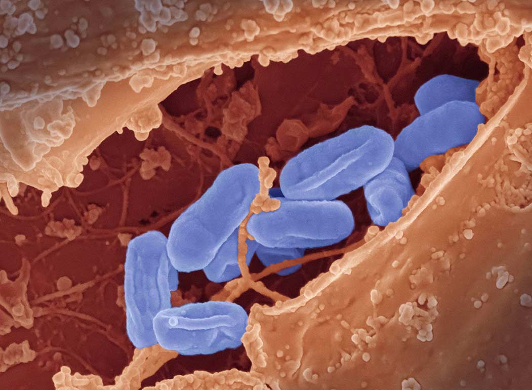 Modular el microbioma para aliviar el dolor
