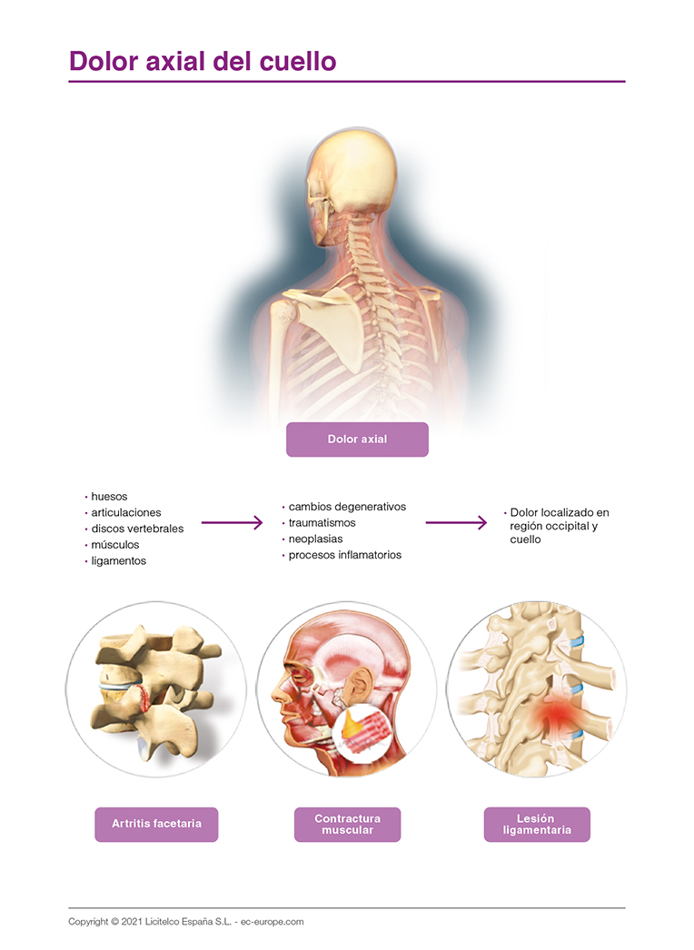 Dolor axial del cuello