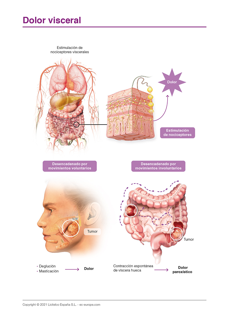 dolor visceral