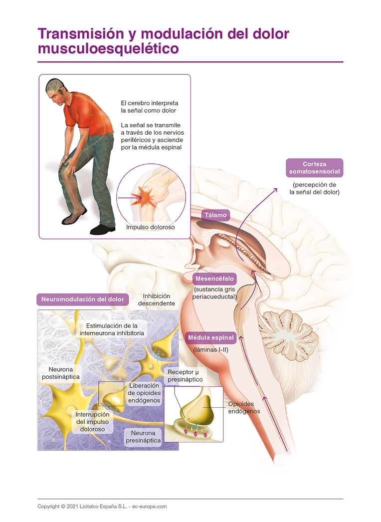 Transmisión y modulación del dolor musculoesquelético