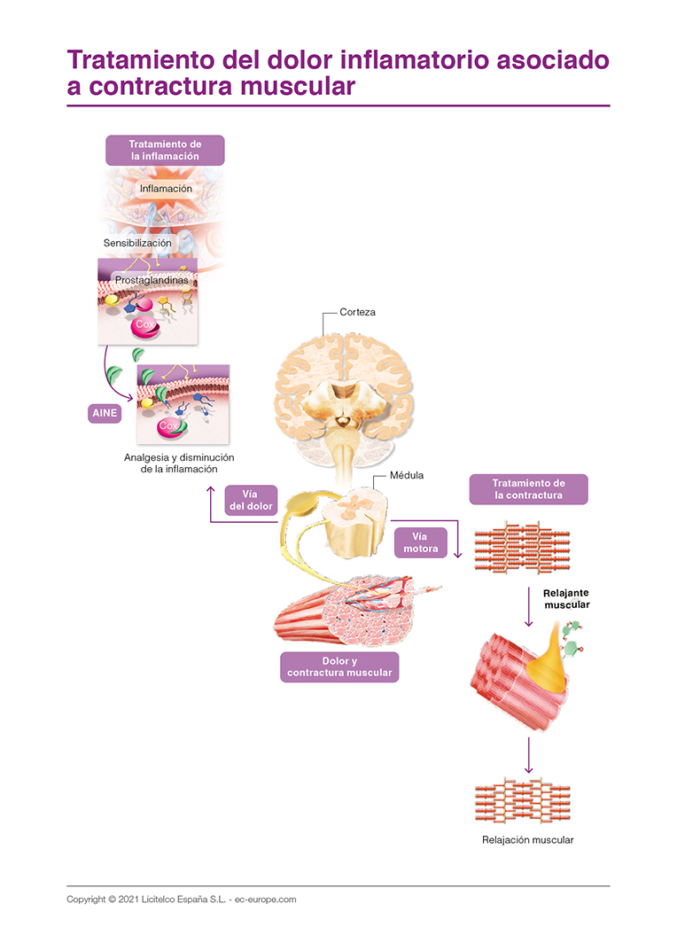 tratamiento del dolor inflamatorio