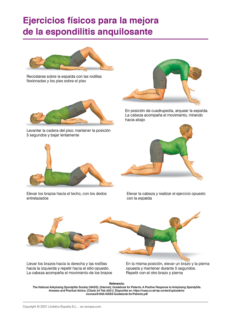 Ejercicios físicos para la mejora de la espondilitis anquilosante
