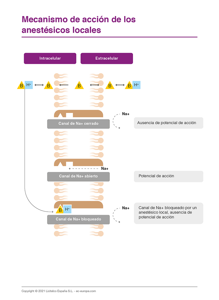 Mecanismo de acción de los anestésicos locales