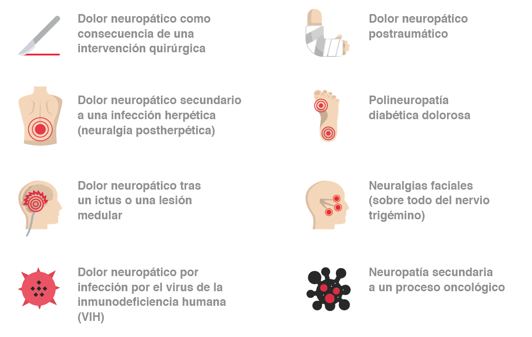 Manifestaciones frecuentes del dolor neuropático