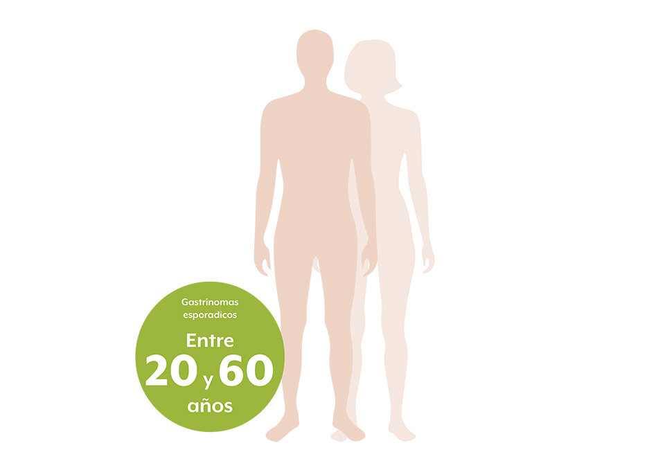 Gastrinomas esporádicos Síndrome Zollinger Ellison