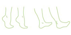entorse-Imagem6