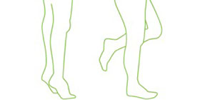entorse-Imagem7