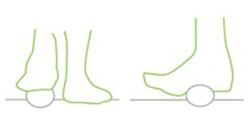 entorse-Imagem9