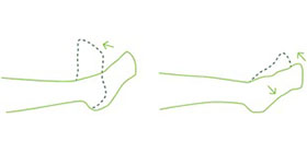 entorse-Imagem1