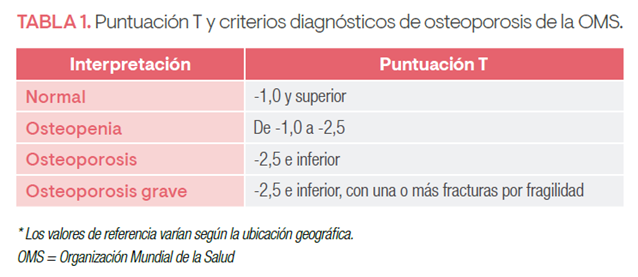 Que es la osteoporosis-Picture2