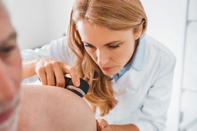 Dermatologist looking at a mole