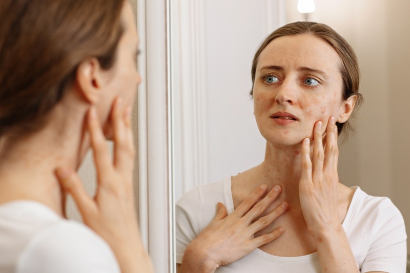 Young woman looking at her skin in a mirror