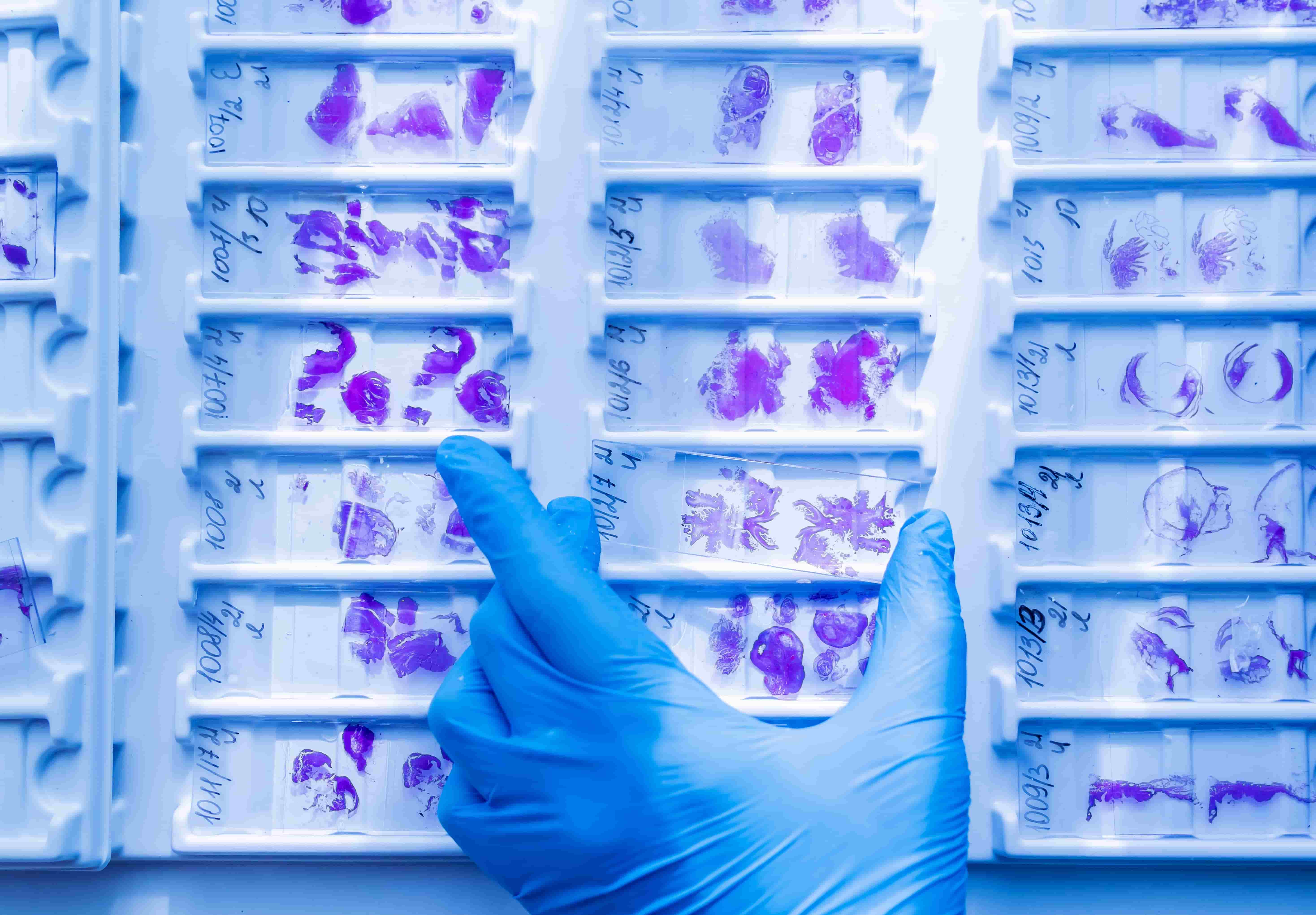 Gloved hand with histology slides