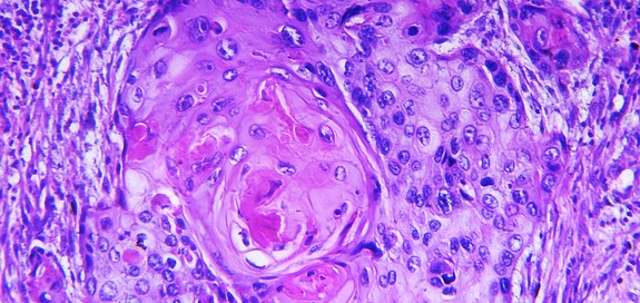 Debating digital pathology? Consider the risk of not doing it