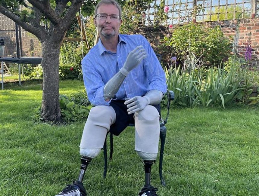 As Craig Mackinlay MP shares his sepsis story what are the signs of the life-threatening condition and  innovative treatments helping survivors?