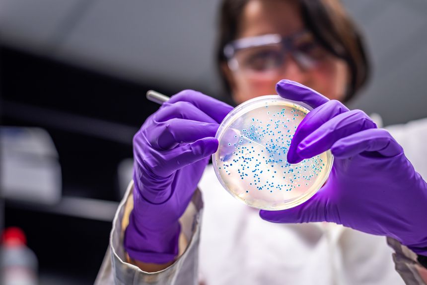 E.coli outbreak: As dozens fall ill public health lawyer explains what the bacteria is and issues key advice to reduce the risk of infection