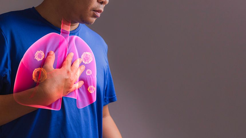 Ahead of Lung Cancer Awareness Month, is asbestos-related lung cancer a disease of the past?