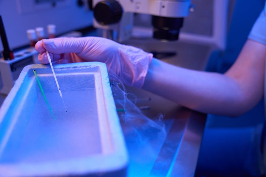 Legal Implications of Unregulated Sperm Donation: Focus on Legal Parenthood