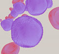 Oncology -Hematology