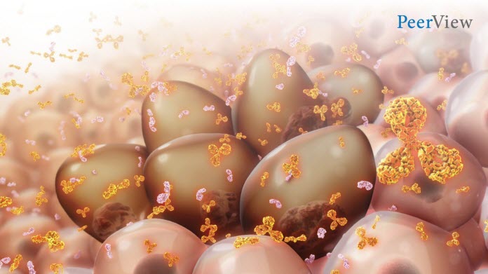Multiple Myeloma
