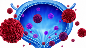 Partnering for Progress: NMIBC Risk Assessment, Surveillance, and Intravesical Therapy