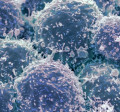 Oncology