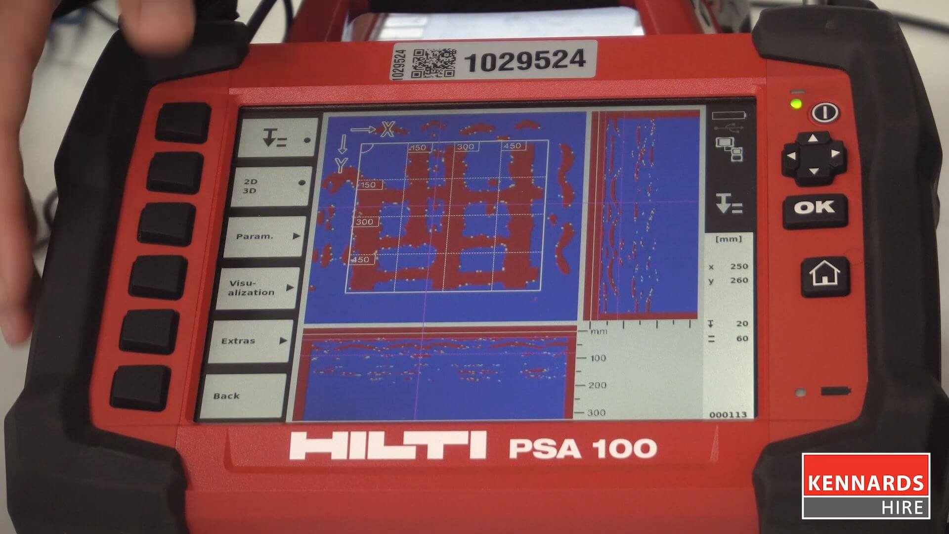 Analysis of the scanned data using a tablet or desktop computer