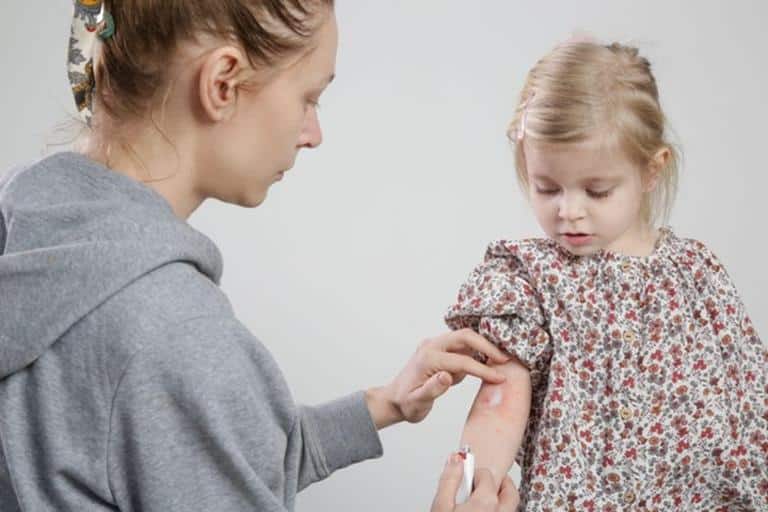 crema piel atopica niños