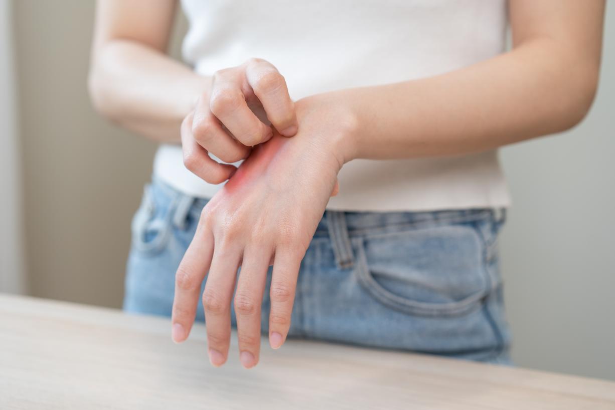 tipos de alergias na pele-2