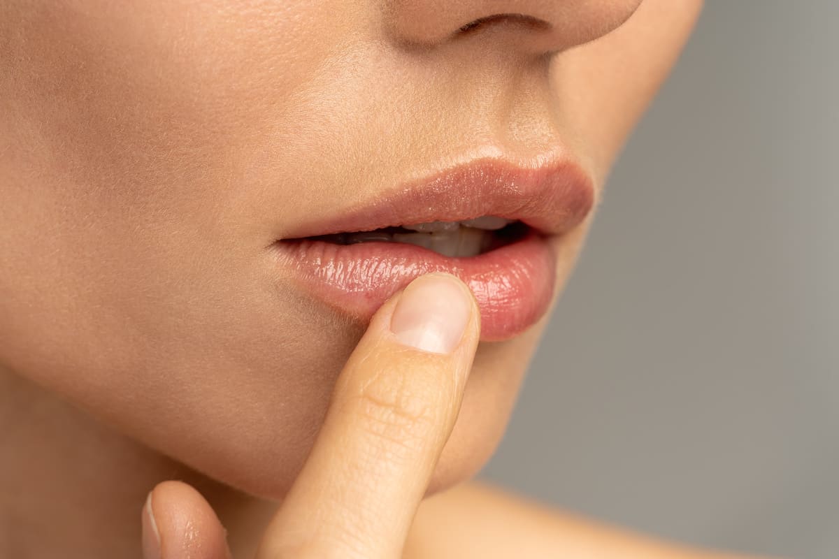 labios resecos