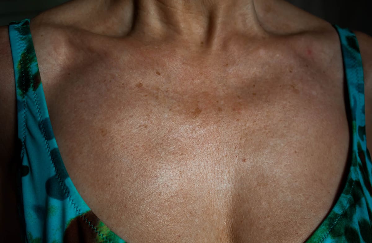 eliminar manchas en el escote