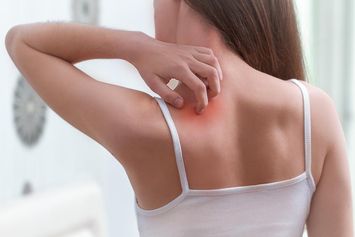 erupciones na pele-2