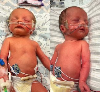 Beck and Brantlee arrived at 32 1/2 weeks gestation and needed three weeks in the NICU at NMMC Gilmore-Amory.