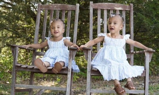 Wilson twin girls