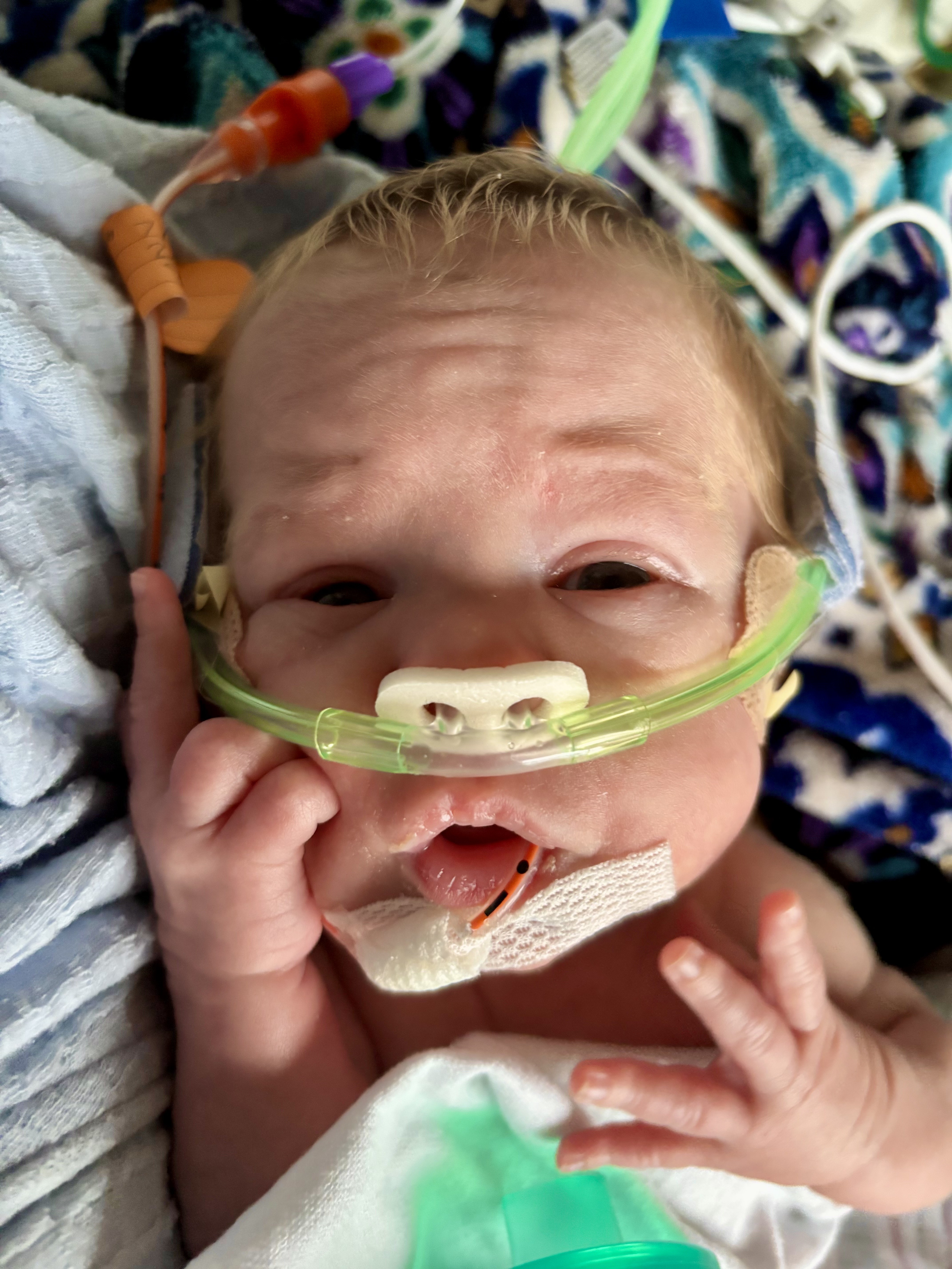 Zee Wilbanks NICU