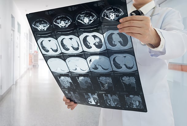 Physician looking at scan results