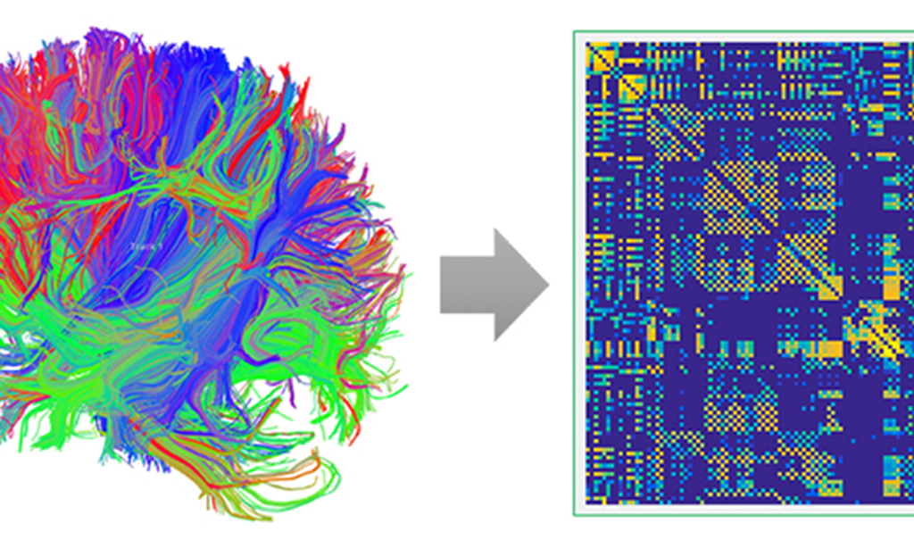Jiayu Zhou to use NSF CAREER Award to enable computers to perform ...