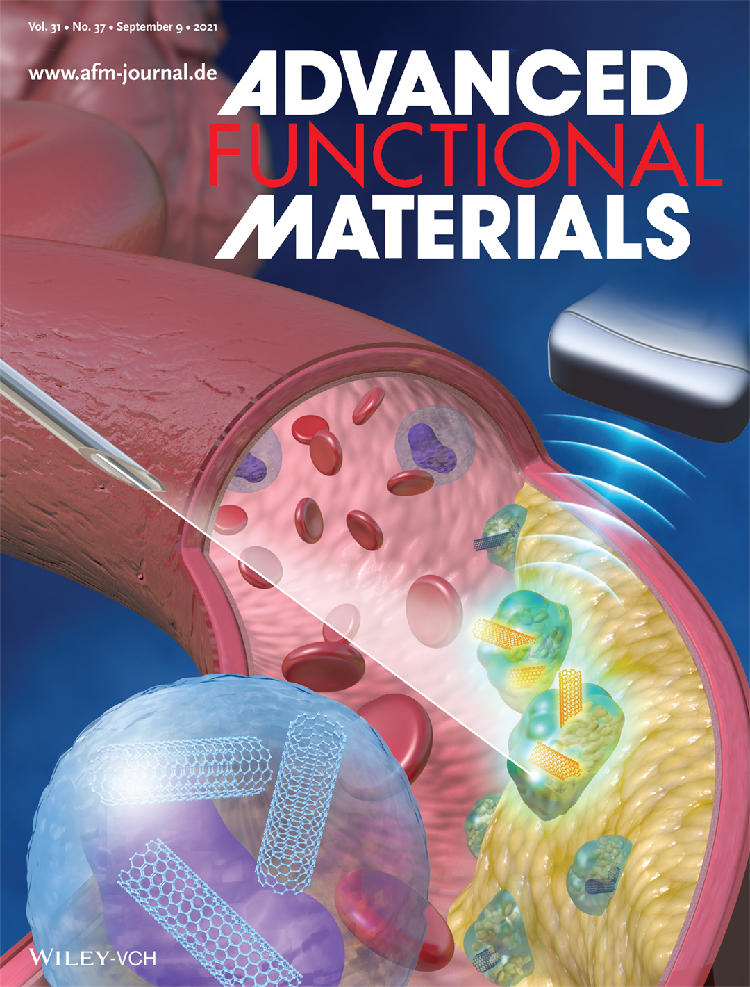 An illustration used as the inside cover of the journal Advanced Functional Materials shows a blood vessel filled with blood cells and little orbs containing tubes that have been injected with a syringe. Some of the tubes have become lodged in a fatty plaque in the blood vessel and these tubes glow yellow when struck with sound waves from an ultrasound. This glowing signal lets researchers