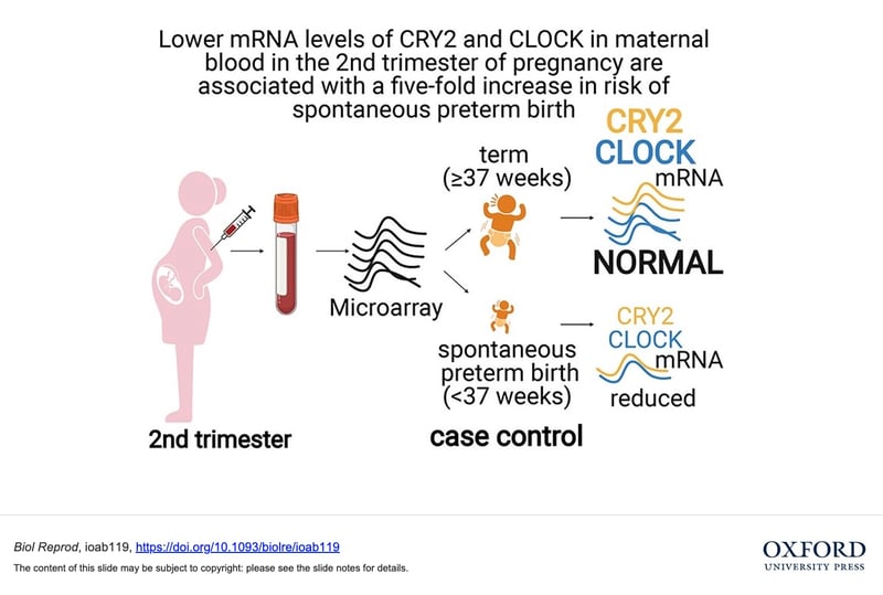 Preterm birth graphic