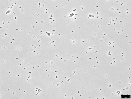 Image of Brucella abortus cells captured by light microscopy 
