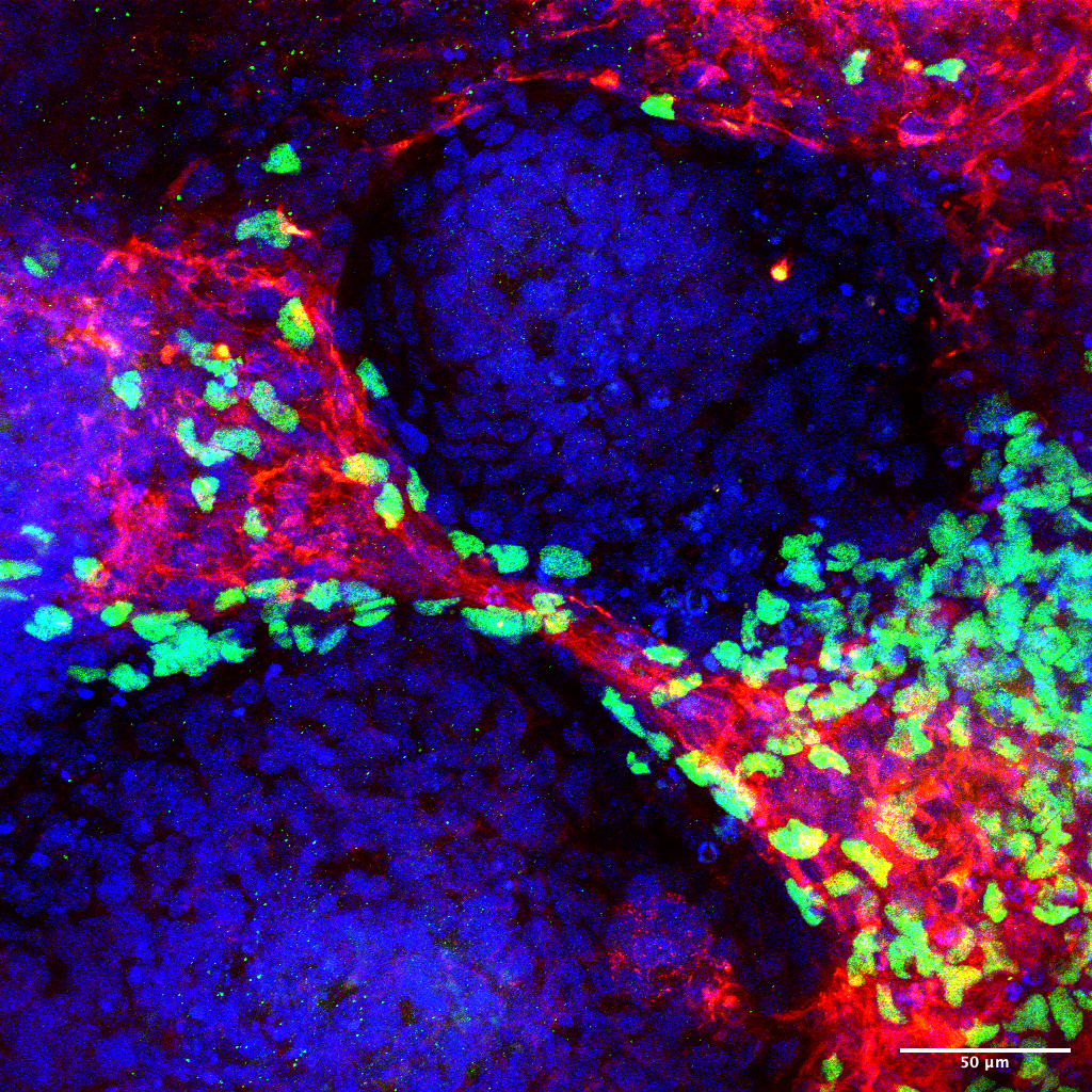Neural crest cells in green (SOX10) migrating along red cardiomyocytes (TNNT2) in a developing heart organoid. Blue is cell nuclei.
