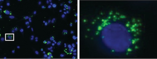 These images show phagocytes (with a dark blue nucleus) with Brucella (green dots) inside of them. The small white box on the left panel is zoomed in on the right. Credit: Daniel Czyz.
