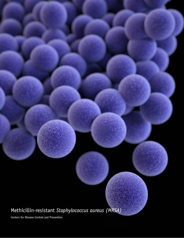 An artistic recreation of MRSA.