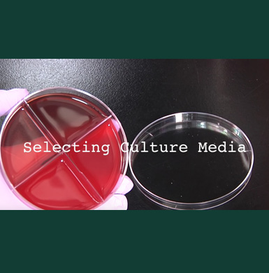 Two petri dishes