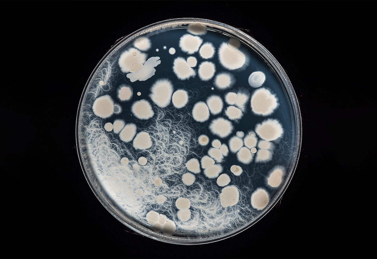 bacteria growing white spots on the surface of a petri dish shown on a black background 